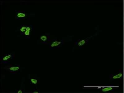 Immunocytochemistry/Immunofluorescence: HOXC12 Antibody (3E1) [H00003228-M09] - Analysis of monoclonal antibody to HOXC12 on HeLa cell. Antibody concentration 10 ug/ml