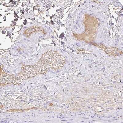 Immunohistochemistry: HOXC12 Antibody [NBP2-31608] - Staining of human colon shows positivity in plasma.