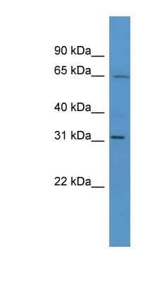 Western Blot: HOXC12 Antibody [NBP1-68929] - Mouse Liver lysate, concentration 0.2-1 ug/ml.