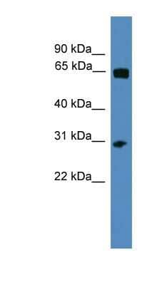 Western Blot: HOXC12 Antibody [NBP1-69214] - ACHN cell lysate, concentration 0.2-1 ug/ml.