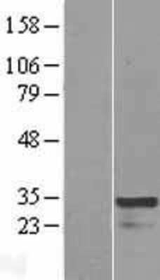 Western Blot: HOXC4 Overexpression Lysate (Adult Normal) [NBP2-07308] Left-Empty vector transfected control cell lysate (HEK293 cell lysate); Right -Over-expression Lysate for HOXC4.