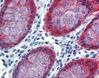 Immunohistochemistry-Paraffin: HOXC8 Antibody [NBP3-10513] - Immunohistochemistry of formalin-fixed, paraffin-embedded human colon tissue after heat-induced antigen retrieval. Antibody concentration 5 ug/ml.