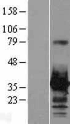 Western Blot: HOXC8 Overexpression Lysate (Adult Normal) [NBL1-11680] Left-Empty vector transfected control cell lysate (HEK293 cell lysate); Right -Over-expression Lysate for HOXC8.