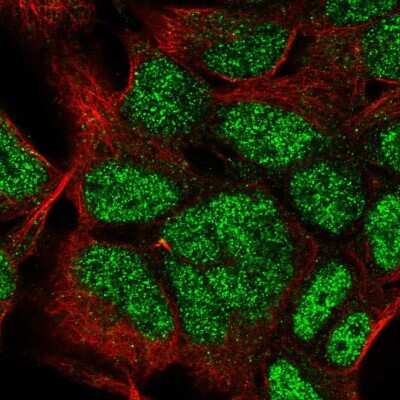 Immunocytochemistry/Immunofluorescence: HOXC9 Antibody [NBP2-56557] - Staining of human cell line HEK 293 shows localization to nucleoplasm.