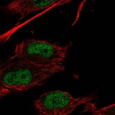 Immunocytochemistry/ Immunofluorescence HOXC9 Antibody