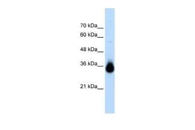 Western Blot: HOXC9 Antibody [NBP2-87597] - WB Suggested Anti-HOXC9 Antibody Titration: 2.5ug/ml. ELISA Titer: 1:1562500. Positive Control: Transfected 293T