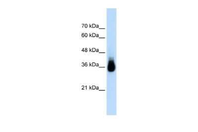 Western Blot: HOXC9 Antibody [NBP2-87598] - WB Suggested Anti-HOXC9 Antibody Titration: 2.5ug/ml. ELISA Titer: 1:312500. Positive Control: Transfected 293T