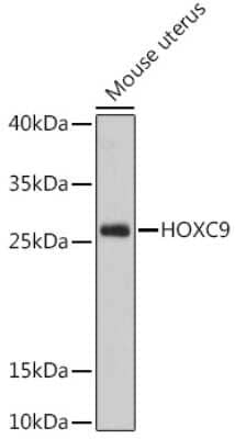 Western Blot: HOXC9 Antibody [NBP3-04479] - Analysis of extracts of Mouse uterus, using HOxC9 antibody at 1:1000 dilution. Secondary antibody: HRP Goat Anti-Rabbit IgG (H+L) at 1:10000 dilution. Lysates/proteins: 25ug per lane. Blocking buffer: 3% nonfat dry milk in TBST. Detection: ECL Basic Kit .