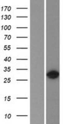 Western Blot: HOXC9 Overexpression Lysate (Adult Normal) [NBP2-07565] Left-Empty vector transfected control cell lysate (HEK293 cell lysate); Right -Over-expression Lysate for HOXC9.