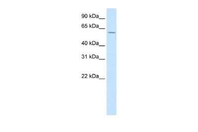 Western Blot: HOXD3 Antibody [NBP3-10464] - Western blot analysis using NBP3-10464 on Human Spinal cord as a positive control. Antibody Titration: 0.2-1 ug/ml