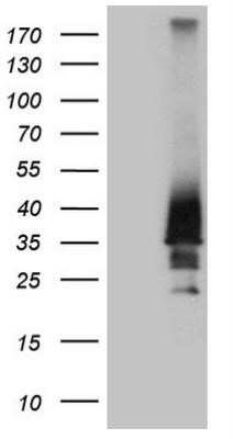 Western Blot: HOXD4 Antibody (OTI1E9) - Azide and BSA Free [NBP2-70919] - HEK293T cells were transfected with the pCMV6-ENTRY control (Left lane) or pCMV6-ENTRY HOXD4 (Right lane) cDNA for 48 hrs and lysed. Equivalent amounts of cell lysates (5 ug per lane) were separated by SDS-PAGE and immunoblotted with anti-HOXD4.