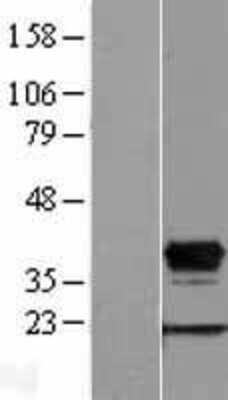 Western Blot: HOXD8 Overexpression Lysate (Adult Normal) [NBL1-11684] Left-Empty vector transfected control cell lysate (HEK293 cell lysate); Right -Over-expression Lysate for HOXD8.