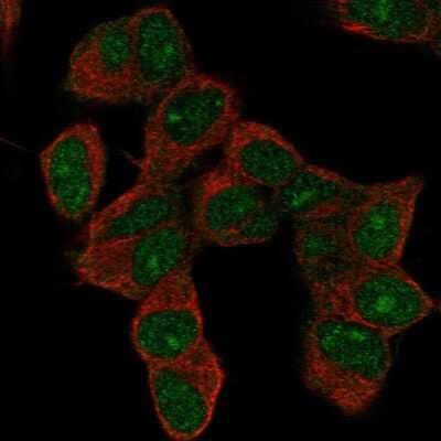 Immunocytochemistry/Immunofluorescence: HOXD9 Antibody [NBP2-55738] - Staining of human cell line SH-SY5Y shows localization to nucleus & nucleoli.