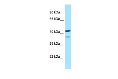 Western Blot: HOXD9 Antibody [NBP2-85077] - WB Suggested Anti-Hoxd9 Antibody. Titration: 1.0 ug/ml. Positive Control: Rat Thymus