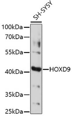 Western Blot: HOXD9 Antibody [NBP3-03891] - Analysis of extracts of SH-SY5Y cells, using HOxD9 antibody at 1:1000 dilution. Secondary antibody: HRP Goat Anti-Rabbit IgG (H+L) at 1:10000 dilution. Lysates/proteins: 25ug per lane. Blocking buffer: 3% nonfat dry milk in TBST. Detection: ECL Basic Kit