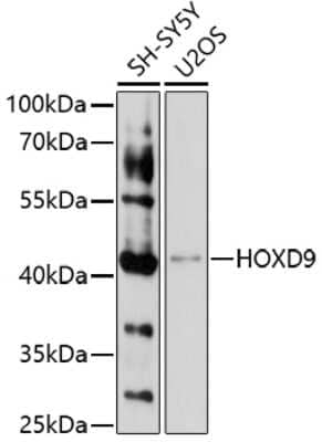 Western Blot: HOXD9 Antibody [NBP3-03891] - Analysis of extracts of various cell lines, using HOxD9 antibody at 1:1000 dilution. Secondary antibody: HRP Goat Anti-Rabbit IgG (H+L) at 1:10000 dilution. Lysates/proteins: 25ug per lane. Blocking buffer: 3% nonfat dry milk in TBST. Detection: ECL Basic Kit