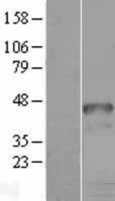 Western Blot: HOXD9 Overexpression Lysate (Adult Normal) [NBL1-11685] Left-Empty vector transfected control cell lysate (HEK293 cell lysate); Right -Over-expression Lysate for HOXD9.