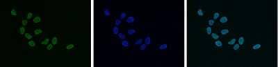 Immunofluorescence: HP1 Alpha, Beta, and Gamma Antibody [NBP2-59154] - HeLa cells were stained with the antibody against HP1alpha, beta and gamma; and with DAPI. Cells were fixed with 4% formaldehyde for 10 minutes and blocked with PBS/TX-100 containing 5% normal goat serum and 1% BSA. The cells were immunofluorescently labelled with the HP1alpha,beta and gamma antibody (left) diluted 1:500 in blocking solution followed by an anti-rabbit antibody conjugated to Alexa Fluor 488. The middle panel shows staining of the nuclei with DAPI. A merge of the two stainings is shown on the right.