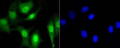 Immunocytochemistry/Immunofluorescence: HP1 alpha Antibody (SR44-03) [NBP2-67349] - Staining HP1 alpha in MCF-7 cells (green). The nuclear counter stain is DAPI (blue). Cells were fixed in paraformaldehyde, permeabilised with 0.25% Triton X100/PBS.