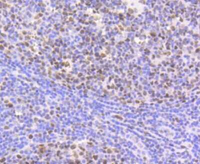 Immunohistochemistry-Paraffin: HP1 alpha Antibody (SR44-03) [NBP2-67349] - Analysis of paraffin-embedded human tonsil tissue using anti-HP1 alpha antibody. Counter stained with hematoxylin.