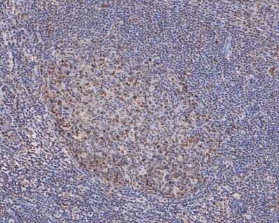 Immunohistochemistry-Paraffin: HP1 alpha Antibody (SR44-03) [NBP2-67349] - Analysis of paraffin-embedded human tonsil tissue with Rabbit anti-HP1 alpha antibody washed with ddH2O and PBS, and then probed with the primary antibody  at 1/50 dilution for 1 hour at room temperature. The detection was performed using an HRP conjugated compact polymer system. DAB was used as the chromogen. Tissues were counterstained with hematoxylin and mounted with DPX.