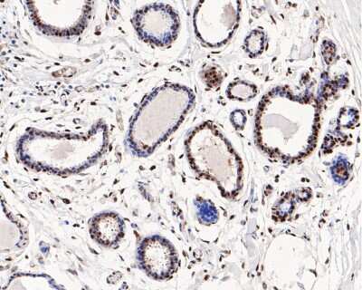 Immunohistochemistry-Paraffin: HP1 alpha Antibody (SR44-03) [NBP2-67349] - Analysis of paraffin-embedded human breast tissue with Rabbit anti-HP1 alpha antibody washed with ddH2O and PBS, and then probed with the primary antibody  at 1/200 dilution for 1 hour at room temperature. The detection was performed using an HRP conjugated compact polymer system. DAB was used as the chromogen. Tissues were counterstained with hematoxylin and mounted with DPX.