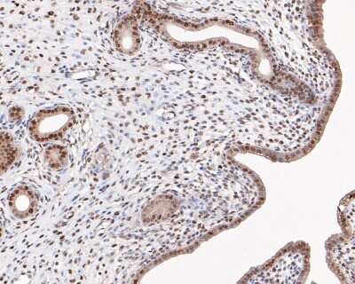 Immunohistochemistry-Paraffin: HP1 alpha Antibody (SR44-03) [NBP2-67349] - Analysis of paraffin-embedded rat uterus tissue with Rabbit anti-HP1 alpha antibody washed with ddH2O and PBS, and then probed with the primary antibody  at 1/200 dilution for 1 hour at room temperature. The detection was performed using an HRP conjugated compact polymer system. DAB was used as the chromogen. Tissues were counterstained with hematoxylin and mounted with DPX.