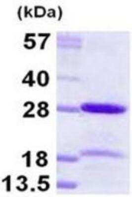 SDS-PAGE Recombinant Human HP1 alpha His Protein