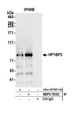 Immunoprecipitation: HP1BP3 Antibody [NBP2-76353] - Detection of human HP1BP3 by western blot of immunoprecipitates. Samples: Whole cell lysate (1.0 mg per IP reaction; 20% of IP loaded) from Jurkat cells prepared using NETN lysis buffer. Antibodies: Affinity purified rabbit anti-HP1BP3 antibody NBP2-76353 used for IP at 100 ul per reaction. HP1BP3 was also immunoprecipitated by another rabbit anti-HP1BP3 antibody. For blotting immunoprecipitated HP1BP3, NBP2-76353 was used at 1:1000. Detection: Chemiluminescence with an exposure time of 3 seconds.