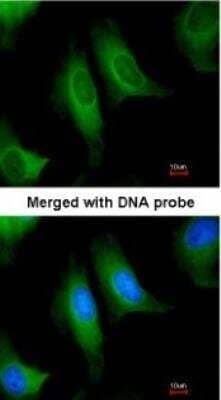 Immunocytochemistry/Immunofluorescence: HPCL Antibody [NBP1-31571] - Paraformaldehyde-fixed HeLa, using antibody at 1:200 dilution.