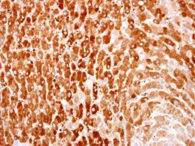 Immunohistochemistry-Paraffin: HPCL Antibody [NBP1-31571] - HPCL antibody detects HPCL protein at cytosol on human normal liver by immunohistochemical analysis. Sample: Paraffin-embedded human normal liver.HPCL antibody dilution: 1:500. Antigen Retrieval: Trilogy (EDTA based, pH 8.0) buffer, 15min