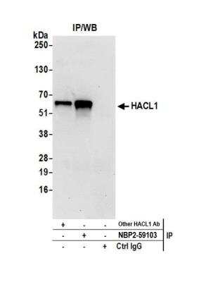 Immunoprecipitation: HPCL Antibody [NBP2-59103] - Detection of human HACL1 by western blot of immunoprecipitates. Samples: Whole cell lysate (0.5 or 1.0 mg per IP reaction; 20% of IP loaded) from 293T cells prepared using NETN lysis buffer. Antibodies: Affinity purified rabbit anti-HACL1 antibody NBP2-59103 used for IP at 20 ul per reaction. HACL1 was also immunoprecipitated by another rabbit anti-HACL1 antibody. For blotting immunoprecipitated HACL1, NBP2-59103 was used at 1:250. Detection: Chemiluminescence with an exposure time of 30 seconds.