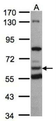 Western Blot: HPCL Antibody [NBP1-31571] - Sample(30 ug whole cell lysate)A:293T 7.5% SDS PAGE, antibody diluted at 1:1000.