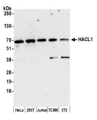 Western Blot: HPCL Antibody [NBP2-59103] - Detection of human and mouse HACL1 by western blot. Samples: Whole cell lysate (15 ug) from HeLa, 293T, Jurkat, mouse TCMK-1, and mouse NIH3T3 cells prepared using NETN lysis buffer. Antibody: Affinity purified rabbit anti-HACL1 antibody NBP2-59103 used for WB at 1:1000. Detection: Chemiluminescence with an exposure time of 3 minutes.Previous