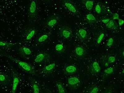 Immunocytochemistry/Immunofluorescence: HPD Antibody [NBP2-98599] - Immunofluorescence staining of HPD in U2OS cells. Cells were fixed with 4% PFA, permeabilzed with 0.1% Triton X-100 in PBS, blocked with 10% serum, and incubated with rabbit anti-Human HPD polyclonal antibody (dilution ratio 1:200) at 4C overnight. Then cells were stained with the Alexa Fluor(R)488-conjugated Goat Anti-rabbit IgG Secondary antibody (green). Positive staining was localized to Nucleus.