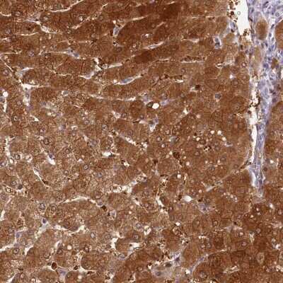 Immunohistochemistry-Paraffin: HPD Antibody [NBP1-89366] - Staining of human liver shows strong cytoplasmic positivity in hepatocytes.