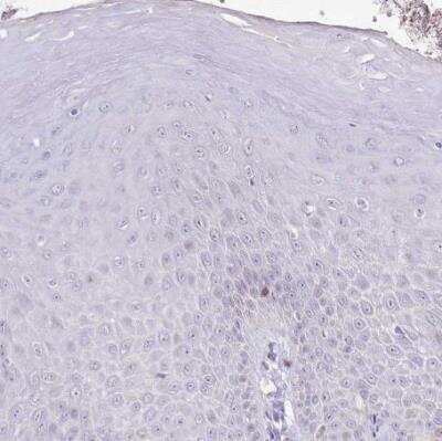 Immunohistochemistry-Paraffin: HPD Antibody [NBP1-89366] - Staining of human squamous epithelia shows no positivity in squamous epithelial cells as expected. 