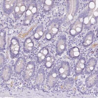 Immunohistochemistry-Paraffin: HPD Antibody [NBP2-32657] - Staining of human duodenum shows low expression as expected.