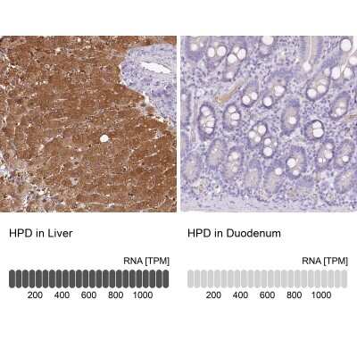 <b>Orthogonal Strategies Validation. </b>Immunohistochemistry-Paraffin: HPD Antibody [NBP2-32657] - Staining in human liver and duodenum tissues using anti-HPD antibody. Corresponding HPD RNA-seq data are presented for the same tissues.