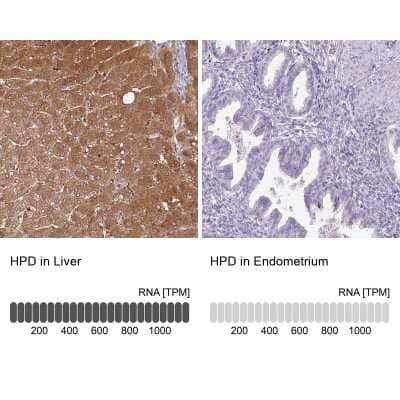 <b>Orthogonal Strategies Validation. </b>Immunohistochemistry-Paraffin: HPD Antibody [NBP2-32657] - Analysis in human liver and endometrium tissues. Corresponding HPD RNA-seq data are presented for the same tissues.