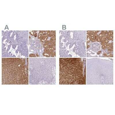 <b>Independent Antibodies Validation. </b>Immunohistochemistry-Paraffin: HPD Antibody [NBP2-32657] - Staining of human endometrium, kidney, liver and squamous epithelia using Anti-HPD antibody NBP2-32657 (A) shows similar protein distribution across tissues to independent antibody NBP1-89366 (B).