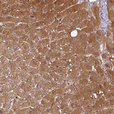 <b>Independent Antibodies Validation. </b>Immunohistochemistry-Paraffin: HPD Antibody [NBP2-32657] - Staining of human liver shows strong cytoplasmic positivity in hepatocytes.