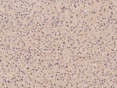 Immunohistochemistry-Paraffin: HPD Antibody [NBP2-98599] - Immunochemical staining of human HPD in human liver with rabbit polyclonal antibody at 1:500 dilution, formalin-fixed paraffin embedded sections.