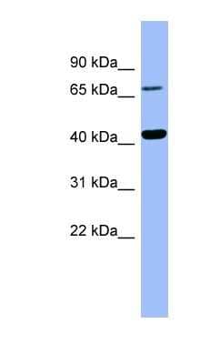 Western Blot: HPD Antibody [NBP1-54804] - Titration: 0.2-1 ug/ml, Positive Control: Human Spleen.