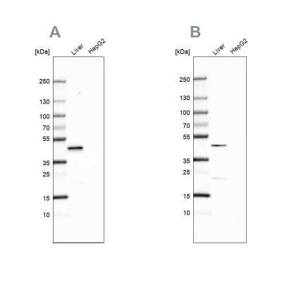 Western Blot: HPD Antibody [NBP2-32657] - Analysis using Anti-HPD antibody NBP2-32657 (A) shows similar pattern to independent antibody NBP1-89366 (B).