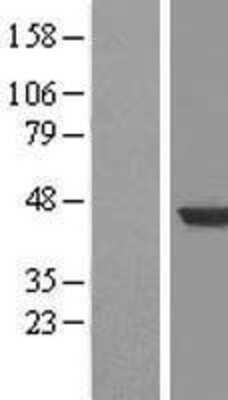 Western Blot: HPD Overexpression Lysate (Adult Normal) [NBL1-11691] Left-Empty vector transfected control cell lysate (HEK293 cell lysate); Right -Over-expression Lysate for HPD.