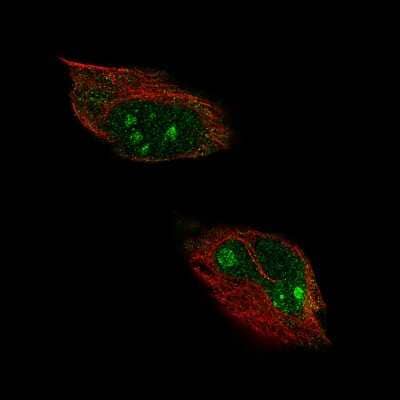 Immunocytochemistry/Immunofluorescence: HPF1 Antibody [NBP1-93973] - Staining of human cell line U-251 shows localization to nucleoli, nucleoplasm and cytosol. Antibody staining is shown in green.