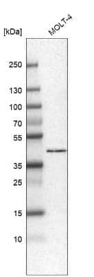 Western Blot: HPF1 Antibody [NBP1-93973] - Analysis in human cell line MOLT-4.
