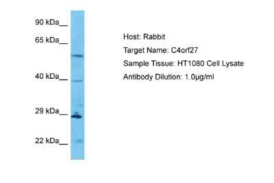 Western Blot: HPF1 Antibody [NBP2-83059] - Host: Rabbit. Target Name: C4orf27. Sample Type: HT1080 Whole Cell lysates. Antibody Dilution: 1.0ug/ml