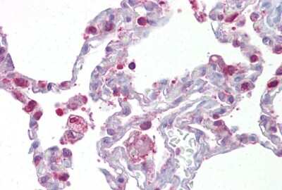 Immunohistochemistry-Paraffin: HPGDS Antibody [NBP1-54625] - Human Lung tissue, 5ug/ml.